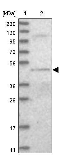 DALRD3 Antibody - BSA Free Western Blot: DALRD3 Antibody - BSA Free [NBP1-84622]