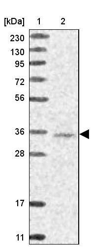 WDR74 Antibody - BSA Free Western Blot: WDR74 Antibody - BSA Free [NBP1-84623]
