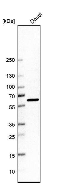 Elp3 Antibody - BSA Free Western Blot: Elp3 Antibody - BSA Free [NBP1-84625]