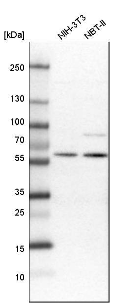 Elp3 Antibody - BSA Free Western Blot: Elp3 Antibody - BSA Free [NBP1-84625]