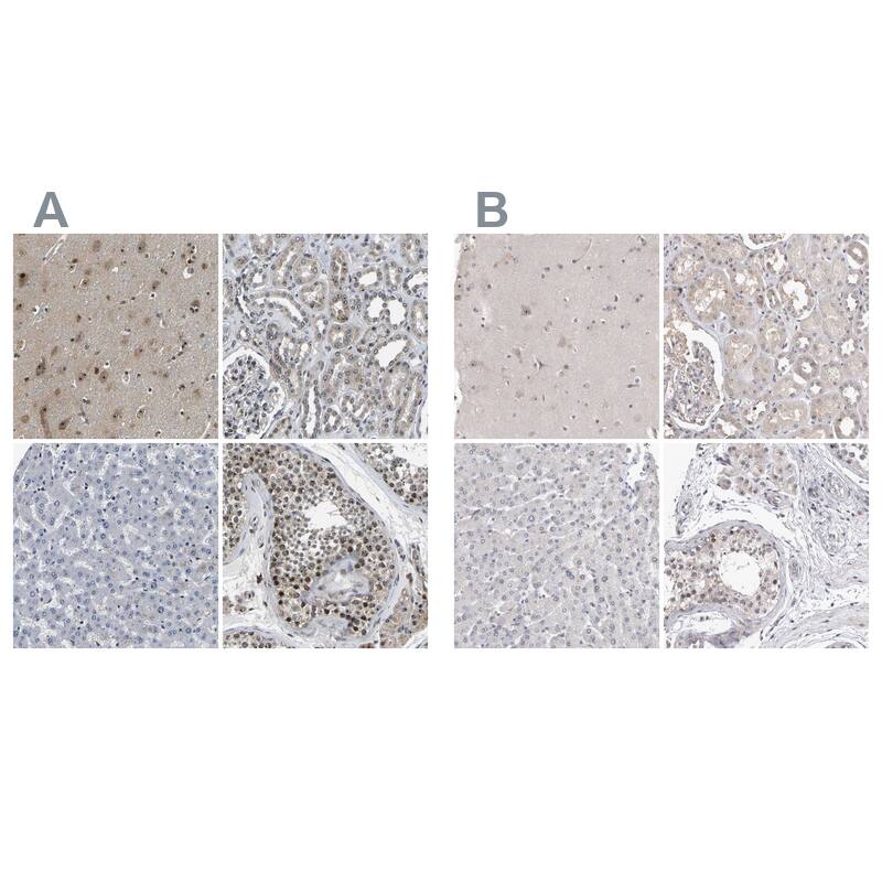 RBM28 Antibody - BSA Free Immunohistochemistry-Paraffin: RBM28 Antibody [NBP1-84632]