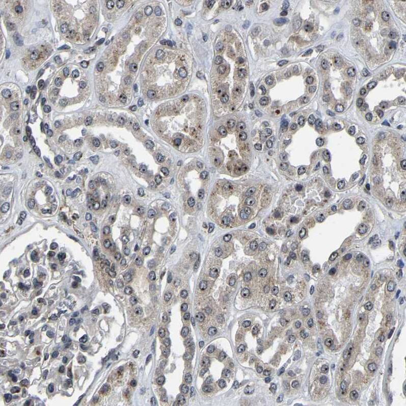 RBM28 Antibody - BSA Free Immunohistochemistry-Paraffin: RBM28 Antibody - BSA Free [NBP1-84632]