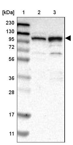 RBM28 Antibody - BSA Free Western Blot: RBM28 Antibody - BSA Free [NBP1-84632]
