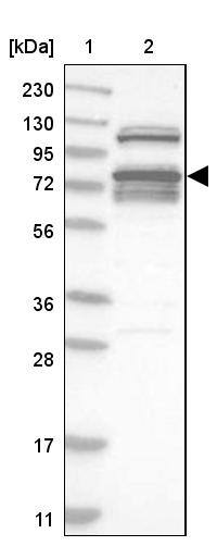 RBM28 Antibody - BSA Free Western Blot: RBM28 Antibody - BSA Free [NBP1-84633]