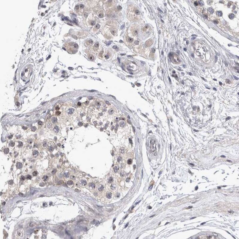 RBM28 Antibody - BSA Free Immunohistochemistry-Paraffin: RBM28 Antibody - BSA Free [NBP1-84633]