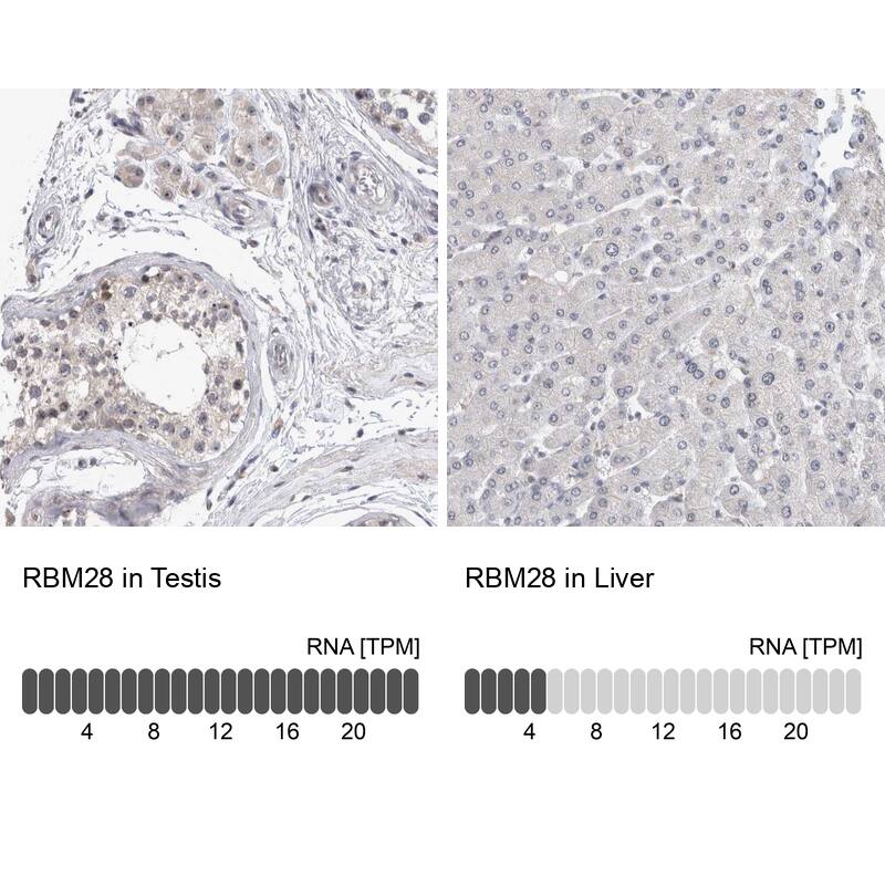 RBM28 Antibody - BSA Free Immunohistochemistry-Paraffin: RBM28 Antibody - BSA Free [NBP1-84633]