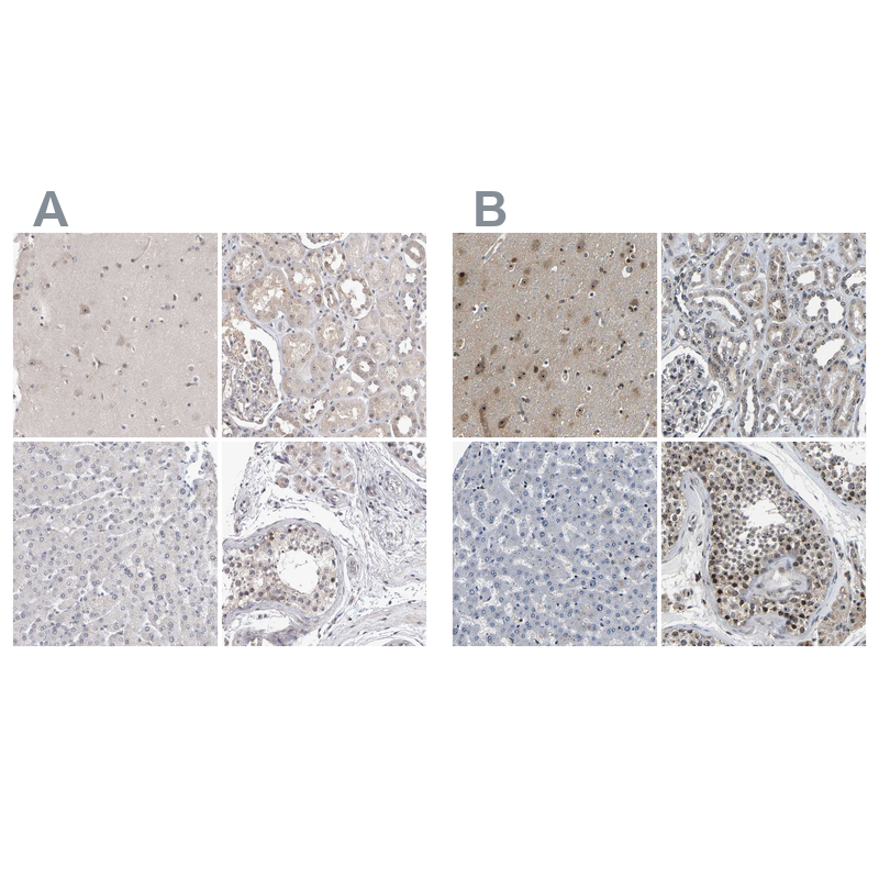 RBM28 Antibody - BSA Free Immunohistochemistry-Paraffin: RBM28 Antibody - BSA Free [NBP1-84633]