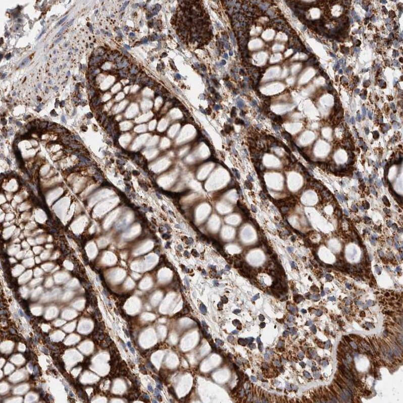 IARS2 Antibody - BSA Free Immunohistochemistry-Paraffin: IARS2 Antibody - BSA Free [NBP1-84638]