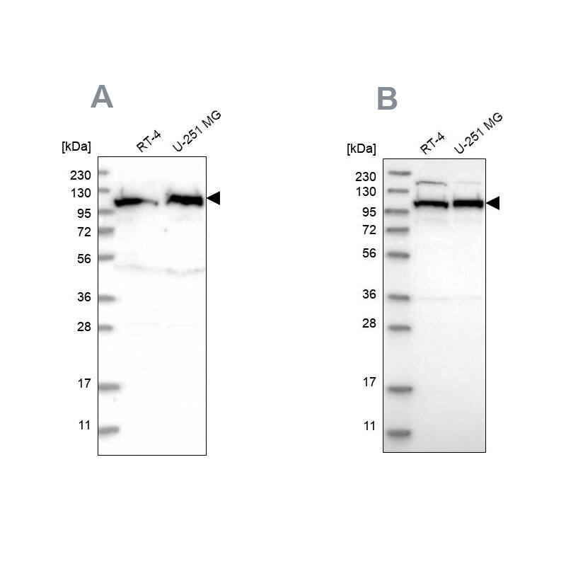 IARS2 Antibody - BSA Free Western Blot: IARS2 Antibody - BSA Free [NBP1-84638]