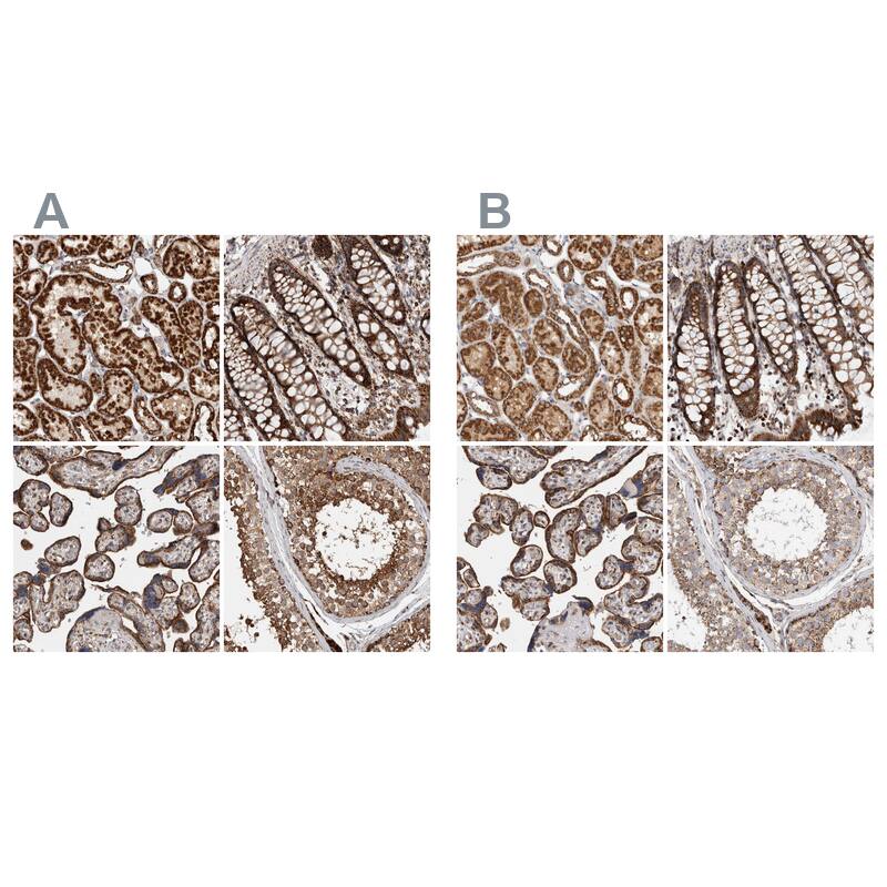 IARS2 Antibody - BSA Free Immunohistochemistry-Paraffin: IARS2 Antibody - BSA Free [NBP1-84638]
