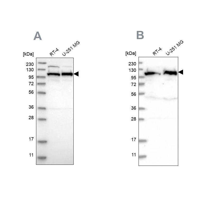 IARS2 Antibody - BSA Free Western Blot: IARS2 Antibody - BSA Free [NBP1-84639]
