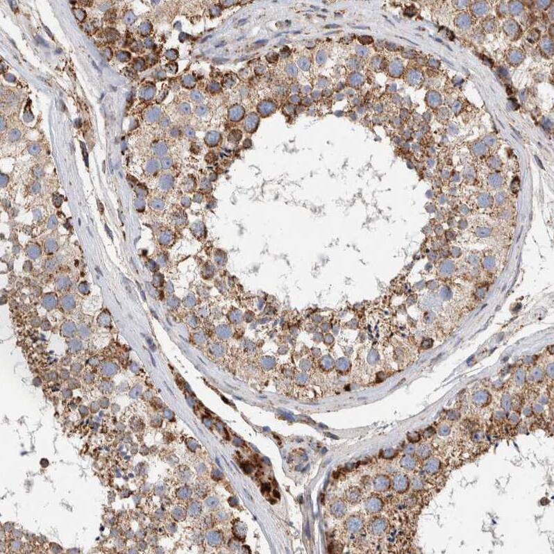 IARS2 Antibody - BSA Free Immunohistochemistry-Paraffin: IARS2 Antibody - BSA Free [NBP1-84639]