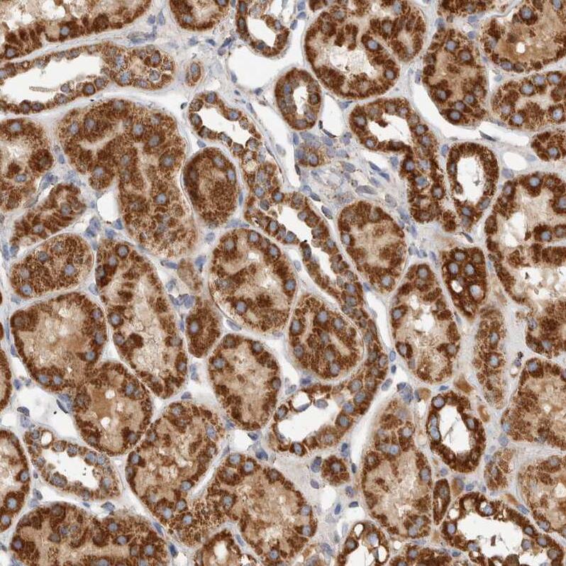 IARS2 Antibody - BSA Free Immunohistochemistry-Paraffin: IARS2 Antibody - BSA Free [NBP1-84639]