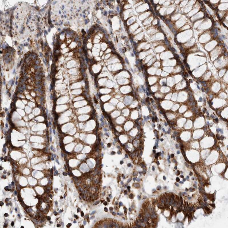 IARS2 Antibody - BSA Free Immunohistochemistry-Paraffin: IARS2 Antibody - BSA Free [NBP1-84639]