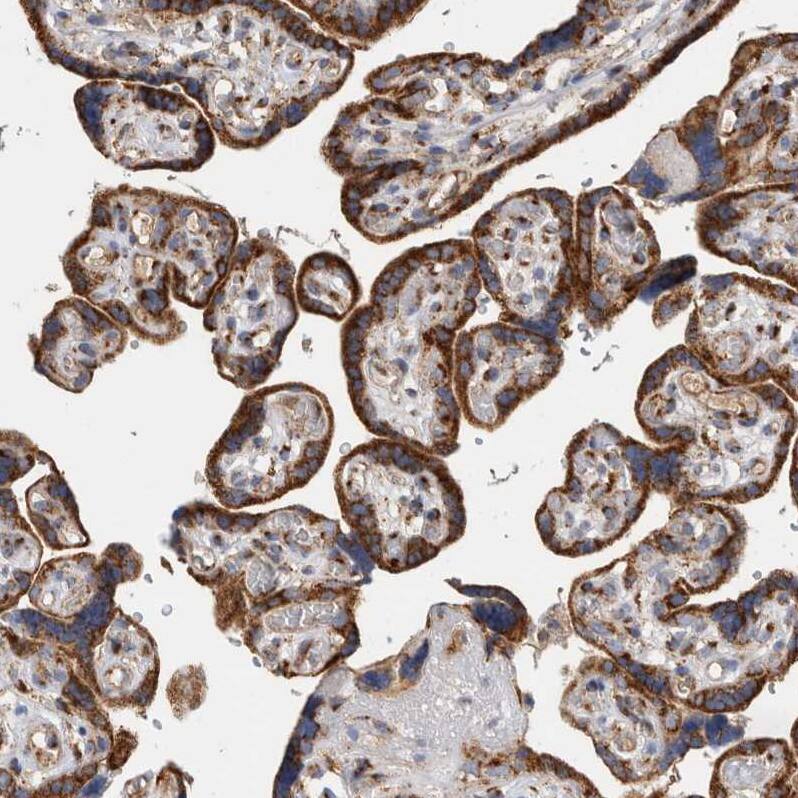 IARS2 Antibody - BSA Free Immunohistochemistry-Paraffin: IARS2 Antibody - BSA Free [NBP1-84639]