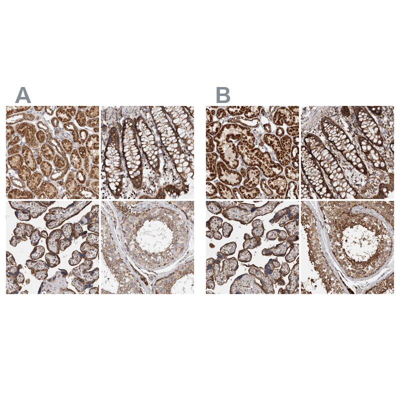 IARS2 Antibody - BSA Free Immunohistochemistry-Paraffin: IARS2 Antibody - BSA Free [NBP1-84639]