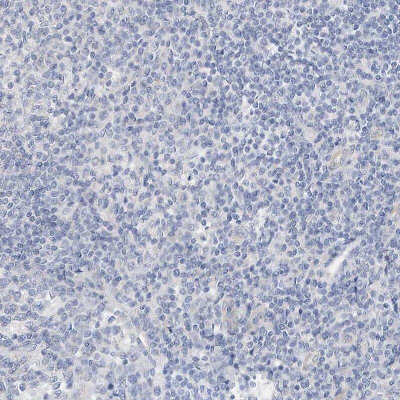 ARHGAP28 Antibody - BSA Free Immunohistochemistry-Paraffin: ARHGAP28 Antibody - BSA Free [NBP1-84640]