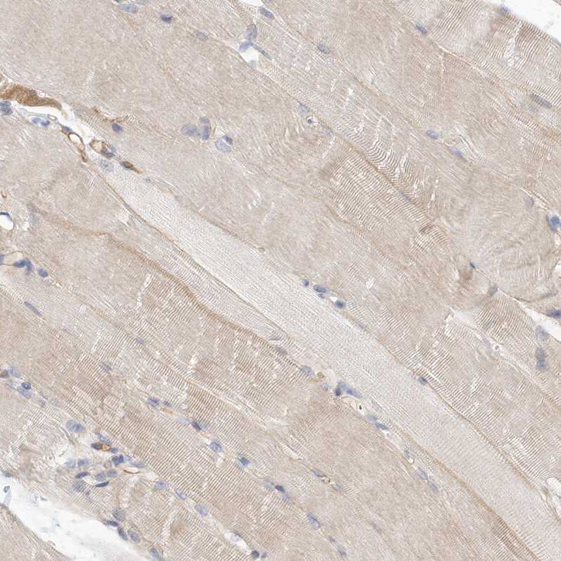 ARHGAP28 Antibody - BSA Free Immunohistochemistry-Paraffin: ARHGAP28 Antibody - BSA Free [NBP1-84640]
