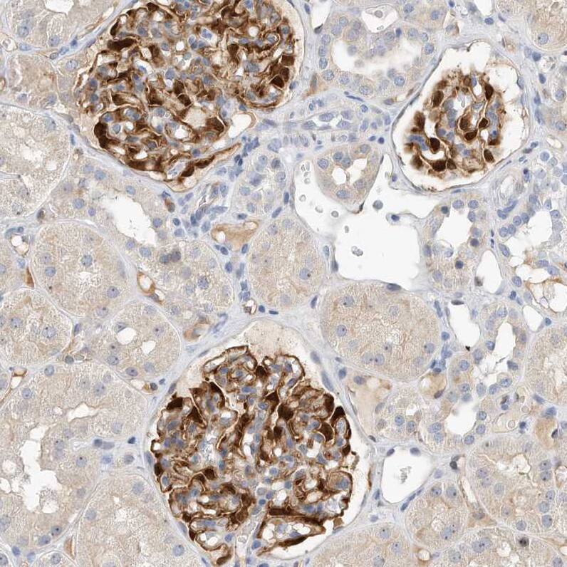ARHGAP28 Antibody - BSA Free Immunohistochemistry-Paraffin: ARHGAP28 Antibody - BSA Free [NBP1-84640]