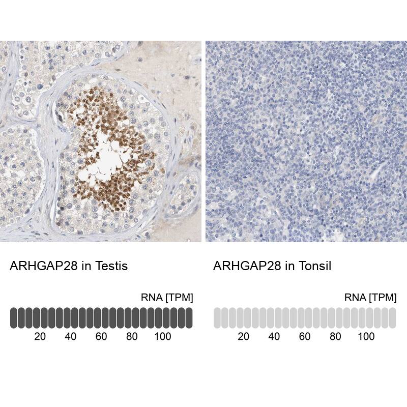 ARHGAP28 Antibody - BSA Free Immunohistochemistry-Paraffin: ARHGAP28 Antibody - BSA Free [NBP1-84640]