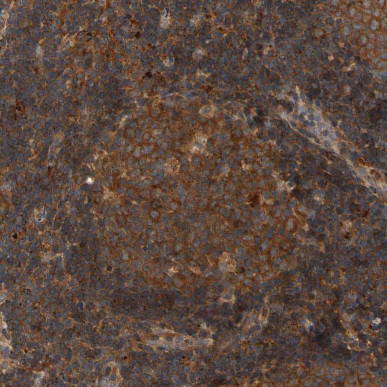 ANKHD1 Antibody - BSA Free Immunohistochemistry-Paraffin: ANKHD1 Antibody - BSA Free [NBP1-84650]