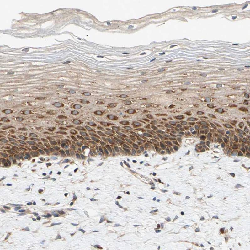 ANKHD1 Antibody - BSA Free Immunohistochemistry-Paraffin: ANKHD1 Antibody - BSA Free [NBP1-84650]