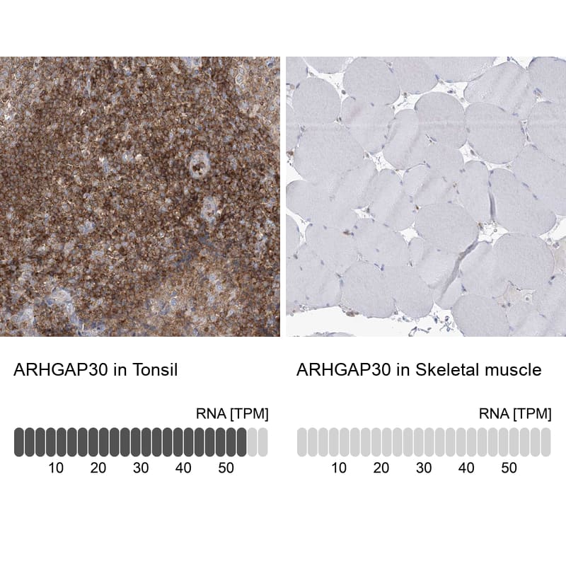 ARHGAP30 Antibody - BSA Free Immunohistochemistry-Paraffin: ARHGAP30 Antibody - BSA Free [NBP1-84653]