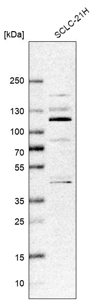 ZNF598 Antibody - BSA Free Western Blot: ZNF598 Antibody - BSA Free [NBP1-84659]