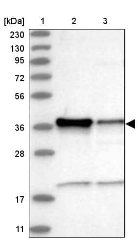 ZC3H8 Antibody - BSA Free Western Blot: ZC3H8 Antibody - BSA Free [NBP1-84661]