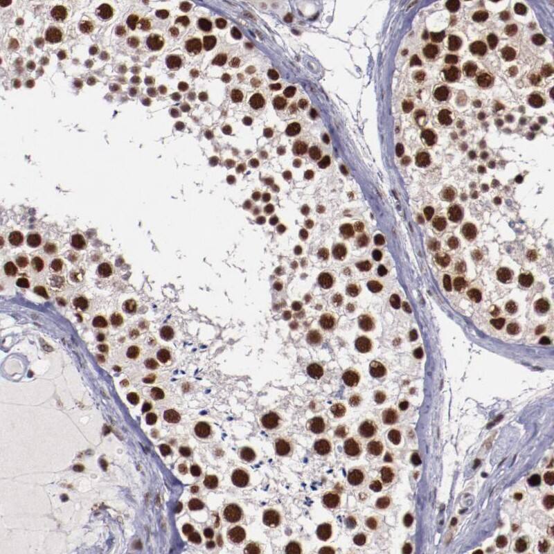 Smek1 Antibody - BSA Free Immunohistochemistry-Paraffin: Smek1 Antibody [NBP1-84664]