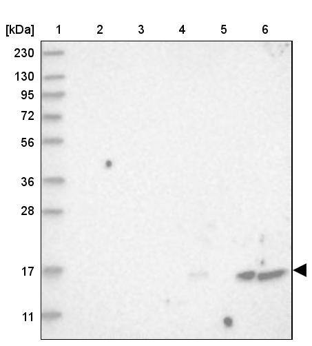 FLAP Antibody - BSA Free Western Blot: FLAP Antibody - BSA Free [NBP1-84666]