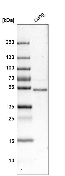 FoxF1 Antibody - BSA Free Western Blot: FoxF1 Antibody - BSA Free [NBP1-84670]