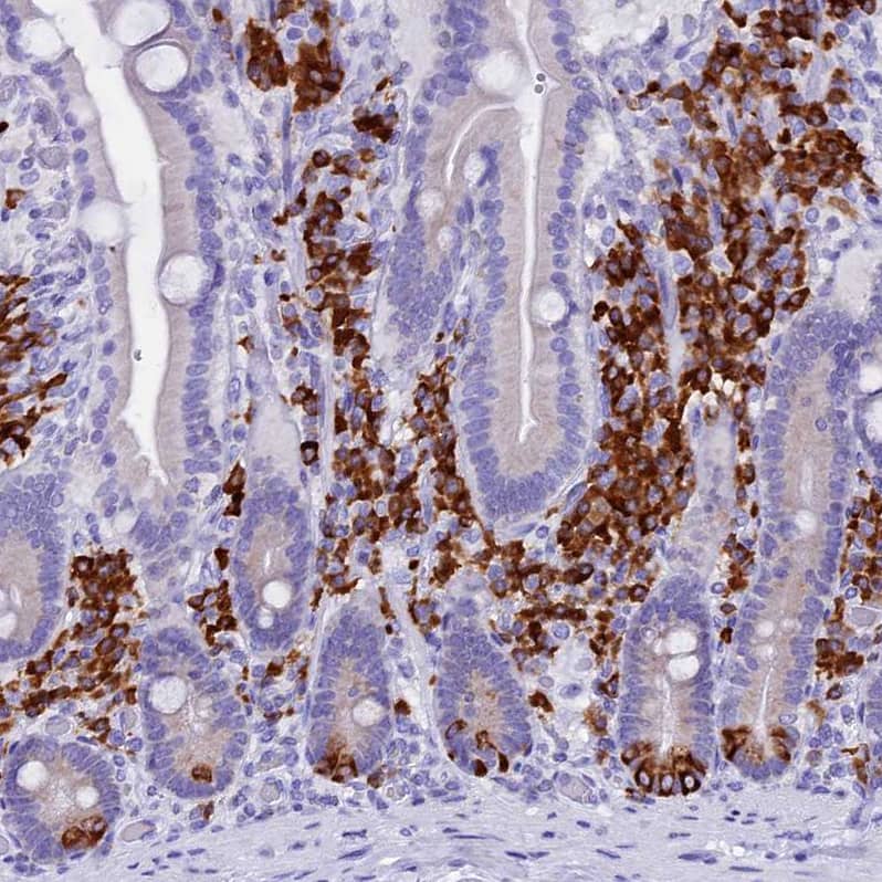 FKBP11 Antibody - BSA Free Immunohistochemistry-Paraffin: FKBP11 Antibody - BSA Free [NBP1-84678]
