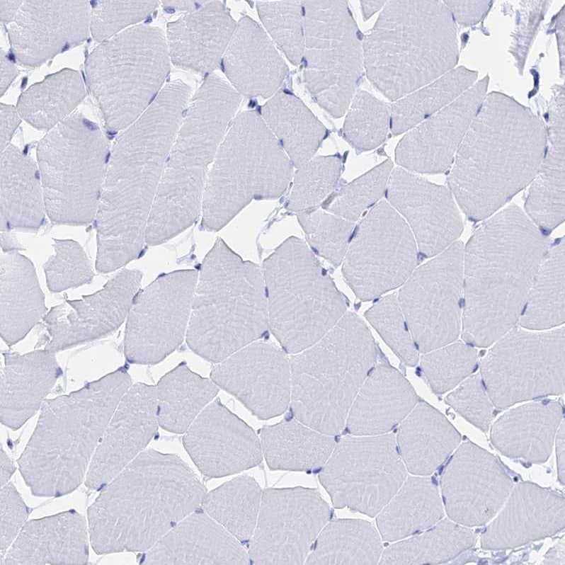 FKBP11 Antibody - BSA Free Immunohistochemistry-Paraffin: FKBP11 Antibody - BSA Free [NBP1-84678]