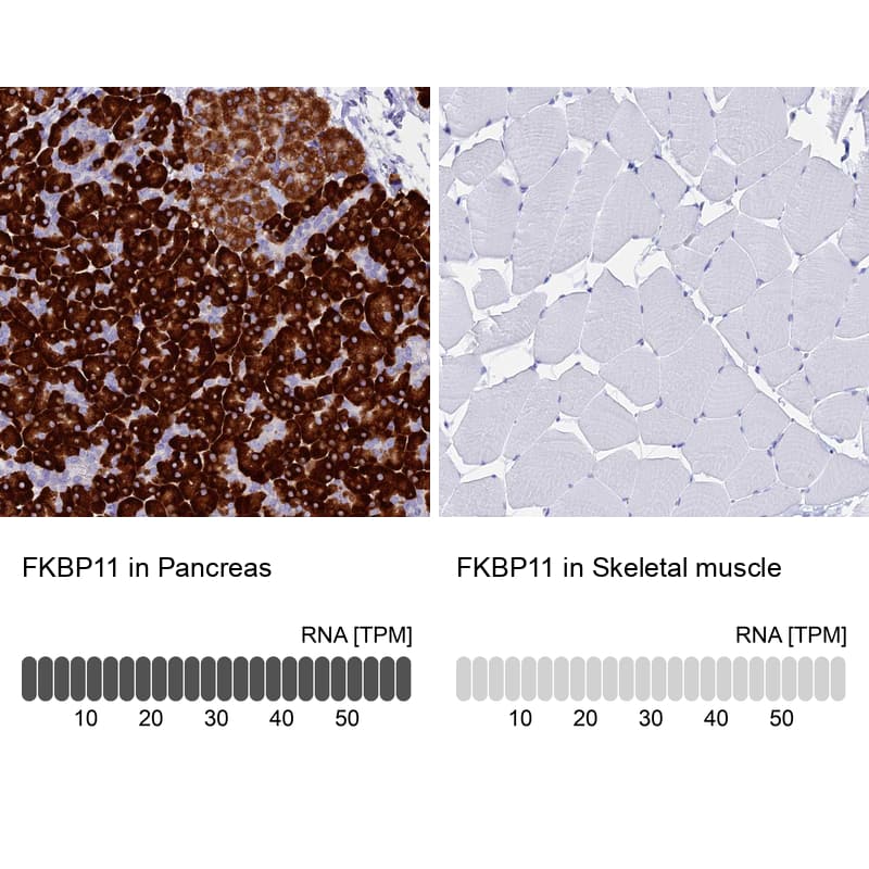 FKBP11 Antibody - BSA Free Immunohistochemistry-Paraffin: FKBP11 Antibody - BSA Free [NBP1-84678]