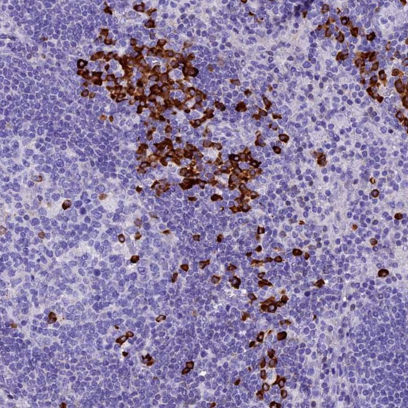 FKBP11 Antibody - BSA Free Immunohistochemistry-Paraffin: FKBP11 Antibody - BSA Free [NBP1-84678]