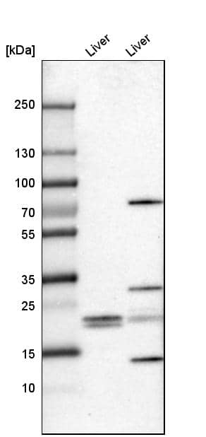 FKBP11 Antibody - BSA Free Western Blot: FKBP11 Antibody - BSA Free [NBP1-84678]