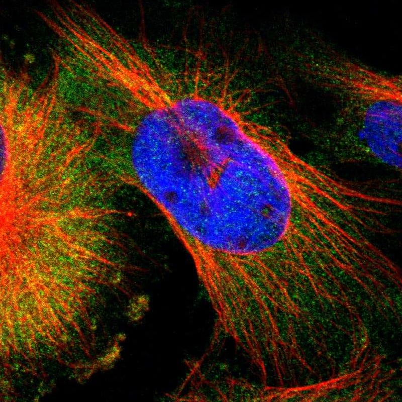 IKK gamma Antibody - BSA Free Immunocytochemistry/ Immunofluorescence: IKK gamma Antibody [NBP1-84681]