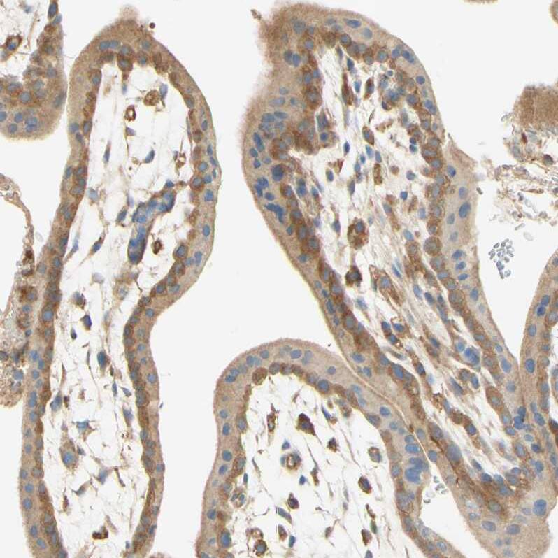 IKK gamma Antibody - BSA Free Immunohistochemistry-Paraffin: IKK gamma Antibody - BSA Free [NBP1-84681]