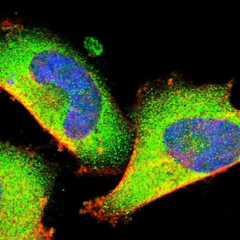 Optineurin Antibody - BSA Free Immunocytochemistry/ Immunofluorescence: Optineurin Antibody [NBP1-84682]