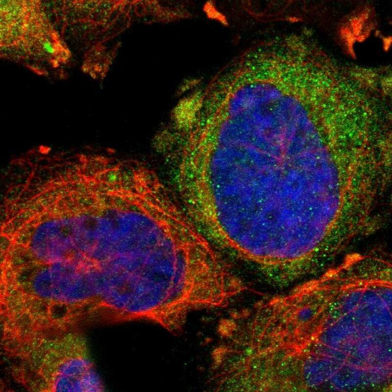Optineurin Antibody - BSA Free Immunocytochemistry/ Immunofluorescence: Optineurin Antibody [NBP1-84683]