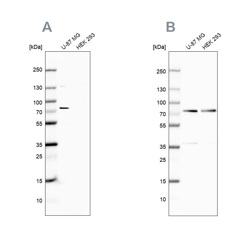 Optineurin Antibody - BSA Free Western Blot: Optineurin Antibody - BSA Free [NBP1-84683]