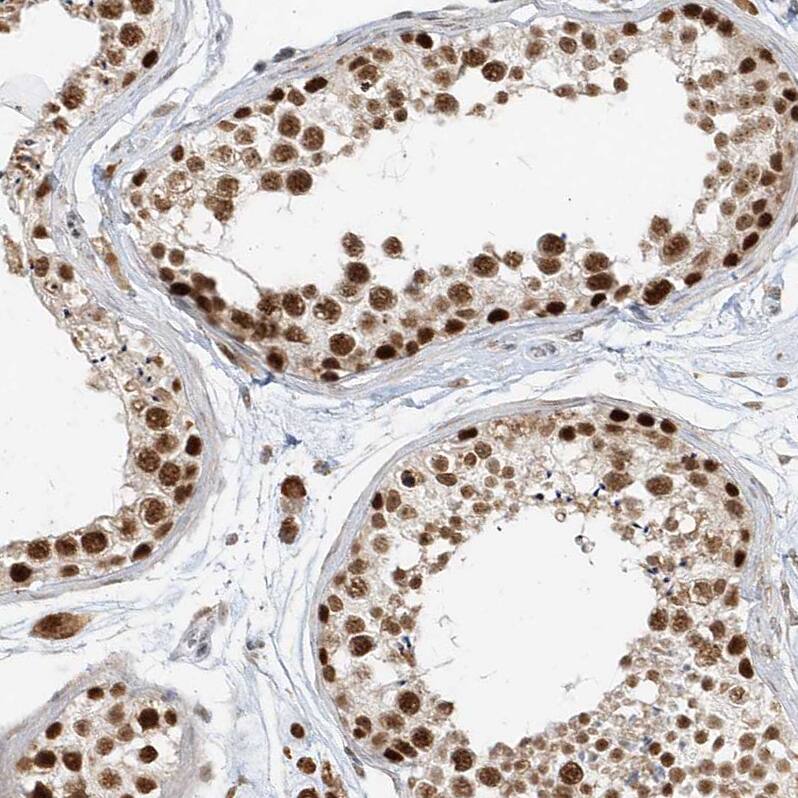 ZNF198 Antibody - BSA Free Immunohistochemistry-Paraffin: ZNF198 Antibody [NBP1-84685]
