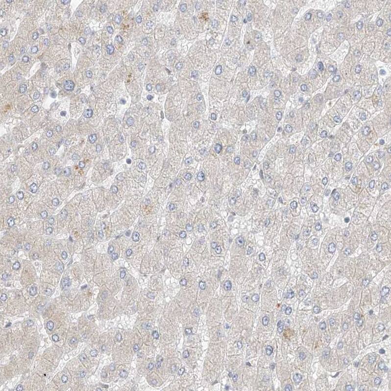 ZNF198 Antibody - BSA Free Immunohistochemistry-Paraffin: ZNF198 Antibody [NBP1-84685]