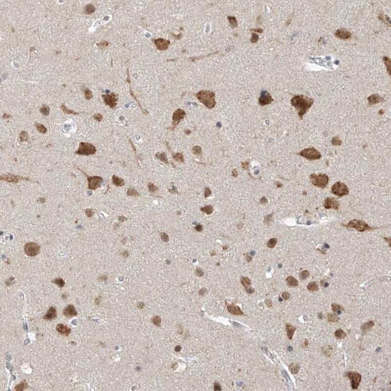 ZNF198 Antibody - BSA Free Immunohistochemistry-Paraffin: ZNF198 Antibody [NBP1-84685]