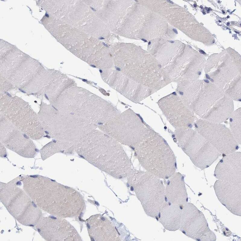 PURL Antibody - BSA Free Immunohistochemistry-Paraffin: PURL Antibody - BSA Free [NBP1-84691]