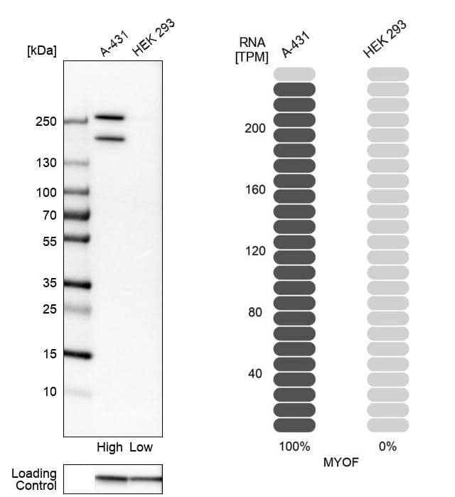 Myoferlin Antibody - BSA Free Western Blot: Myoferlin Antibody - BSA Free [NBP1-84694]