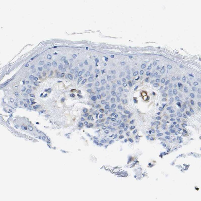 Dysferlin Antibody - BSA Free Immunohistochemistry-Paraffin: Dysferlin Antibody [NBP1-84696]