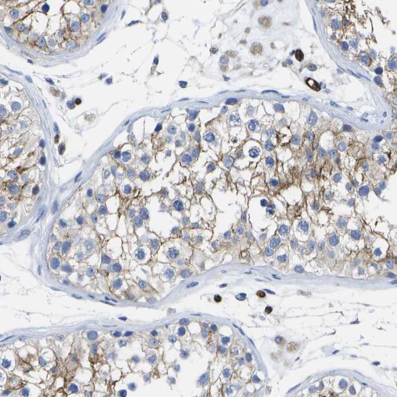 Dysferlin Antibody - BSA Free Immunohistochemistry-Paraffin: Dysferlin Antibody [NBP1-84696]