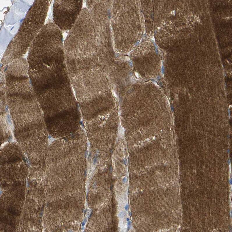 Dysferlin Antibody - BSA Free Immunohistochemistry-Paraffin: Dysferlin Antibody [NBP1-84696]